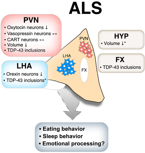 Loss of the metabolism and sleep regulating neuronal populations expressing orexin and oxytocin in the hypothalamus in amyotrophic lateral sclerosis