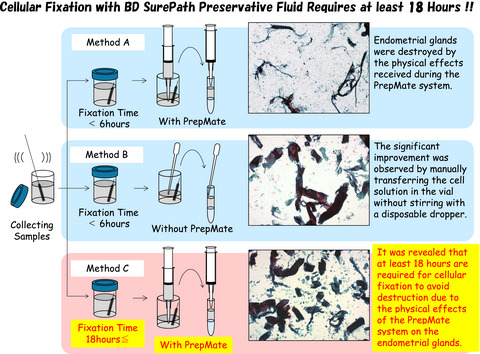 A study on preserving endometrial glandular architecture during preparation using BD SurePath™ liquid‐based cytology reagents: Cellular fixation with preservative fluid requires at least 18 h