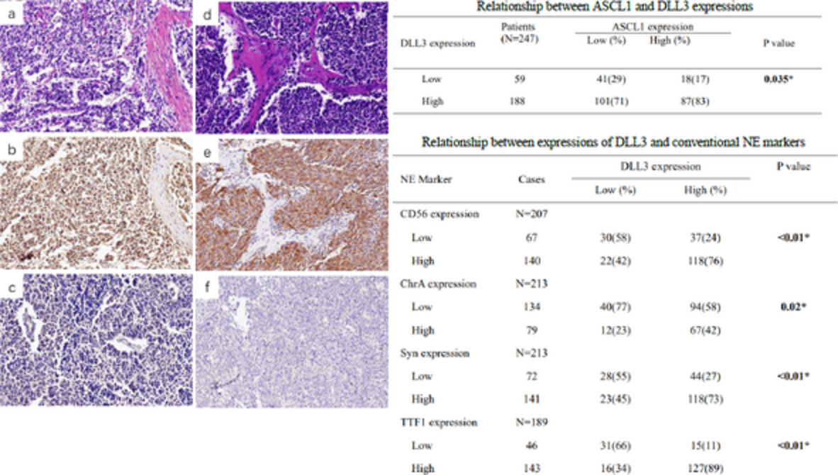 ASCL1 and DLL3 expressions and their clinicopathological implications in surgically resected pure small cell lung cancer: A study of 247 cases from the National Cancer Center of China