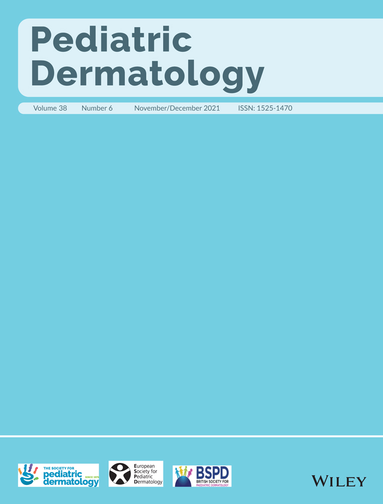 Assessment of published literature regarding skin of color in Pediatric Dermatology