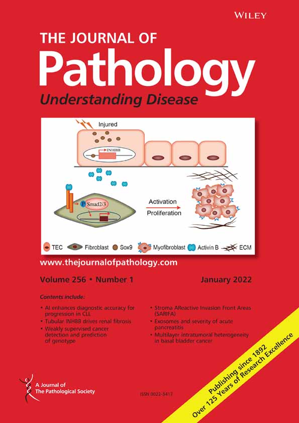 5‐alpha reductase inhibitors induce a prostate luminal to club cell transition in human benign prostatic hyperplasia