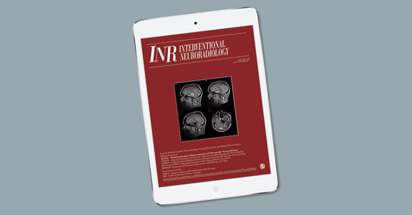 Pipeline embolization of distal posterior inferior cerebellar artery aneurysms