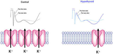 Adult‐onset hypothyroidism causes mechanical hypersensitivity due to peripheral nerve hyperexcitability based on voltage‐gated potassium channel downregulation in male mice