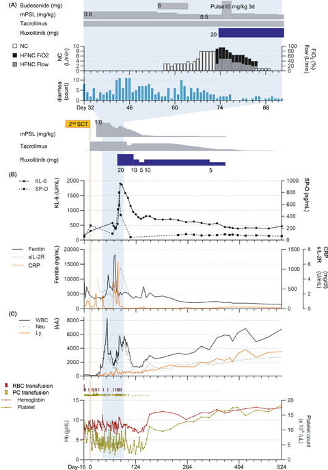 Successful ruxolitinib administration for a patient with steroid‐refractory idiopathic pneumonia syndrome following hematopoietic stem cell transplantation: A case report and literature review