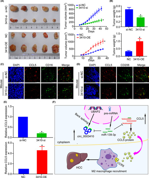 hsa_circ_0003410 promotes hepatocellular carcinoma progression by increasing the ratio of M2/M1 macrophages through the miR‐139‐3p/CCL5 axis