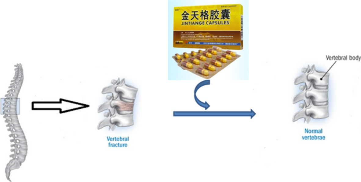 Effect of Artificial Tiger Bone Powder (Jintiange Capsule®) on Vertebral Height Ratio, Cobb's Angle, Bone Mineral Density, and Visual Analog Score