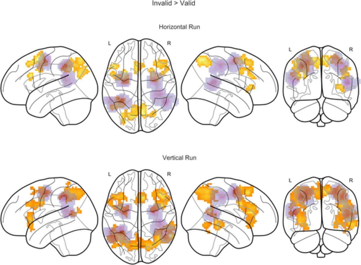 Simultaneous modeling of reaction times and brain dynamics in a spatial cueing task