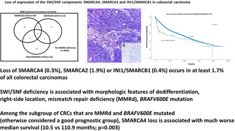 SWI/SNF complex (SMARCA4, SMARCA2, INI1/SMARCB1) deficient colorectal carcinomas are strongly associated with microsatellite instability: An incidence study in 4508 colorectal carcinomas