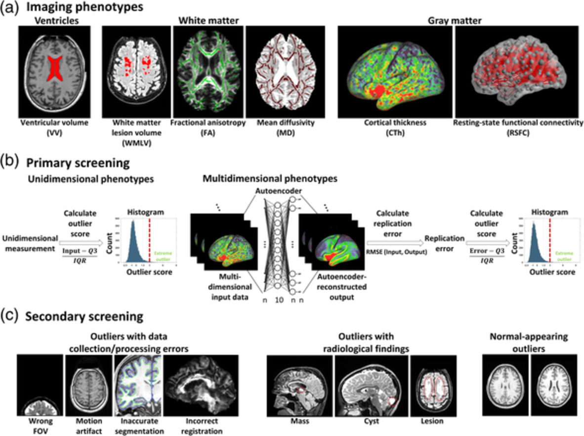Outlier detection in multimodal MRI identifies rare individual phenotypes among more than 15,000 brains