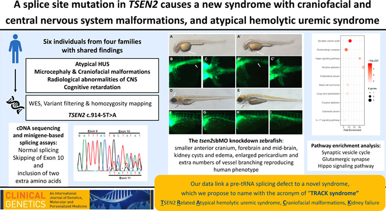 A splice site mutation in the TSEN2 causes a new syndrome with craniofacial and central nervous system malformations, and atypical hemolytic uremic syndrome