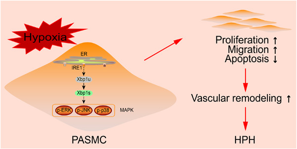Proteomic analysis reveals that Xbp1s promotes hypoxic pulmonary hypertension through the p‐JNK MAPK pathway