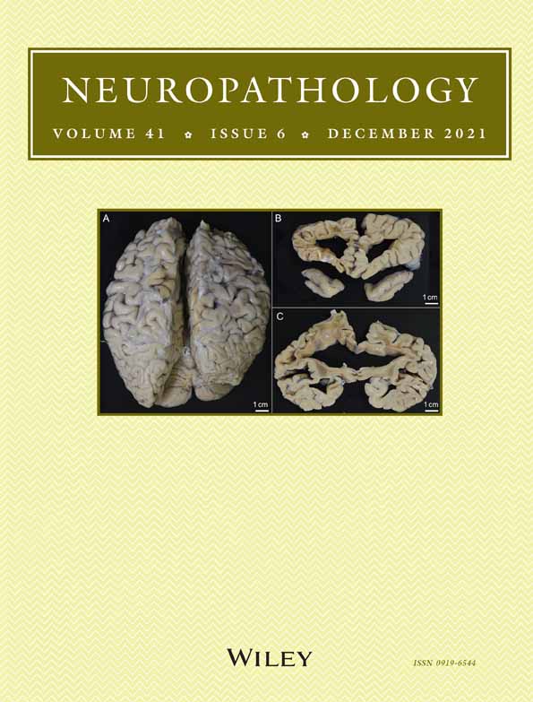 Immunohistochemical expression of osteopontin and collagens in choroid plexus of human brains