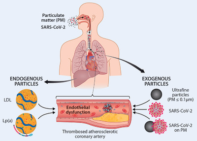 Airborne particles and cardiovascular morbidity in severe inherited hypercholesterolemia: Vulnerable endothelium under multiple attacks