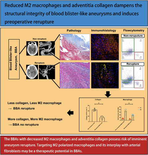 Reduced M2 macrophages and adventitia collagen dampen the structural integrity of blood blister–like aneurysms and induce preoperative rerupture