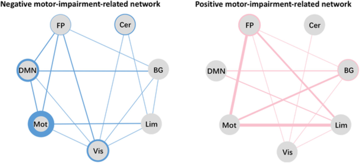 Identifying a whole‐brain connectome‐based model in drug‐naïve Parkinson's disease for predicting motor impairment
