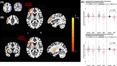 Visuomotor brain network activation and functional connectivity among individuals with autism spectrum disorder