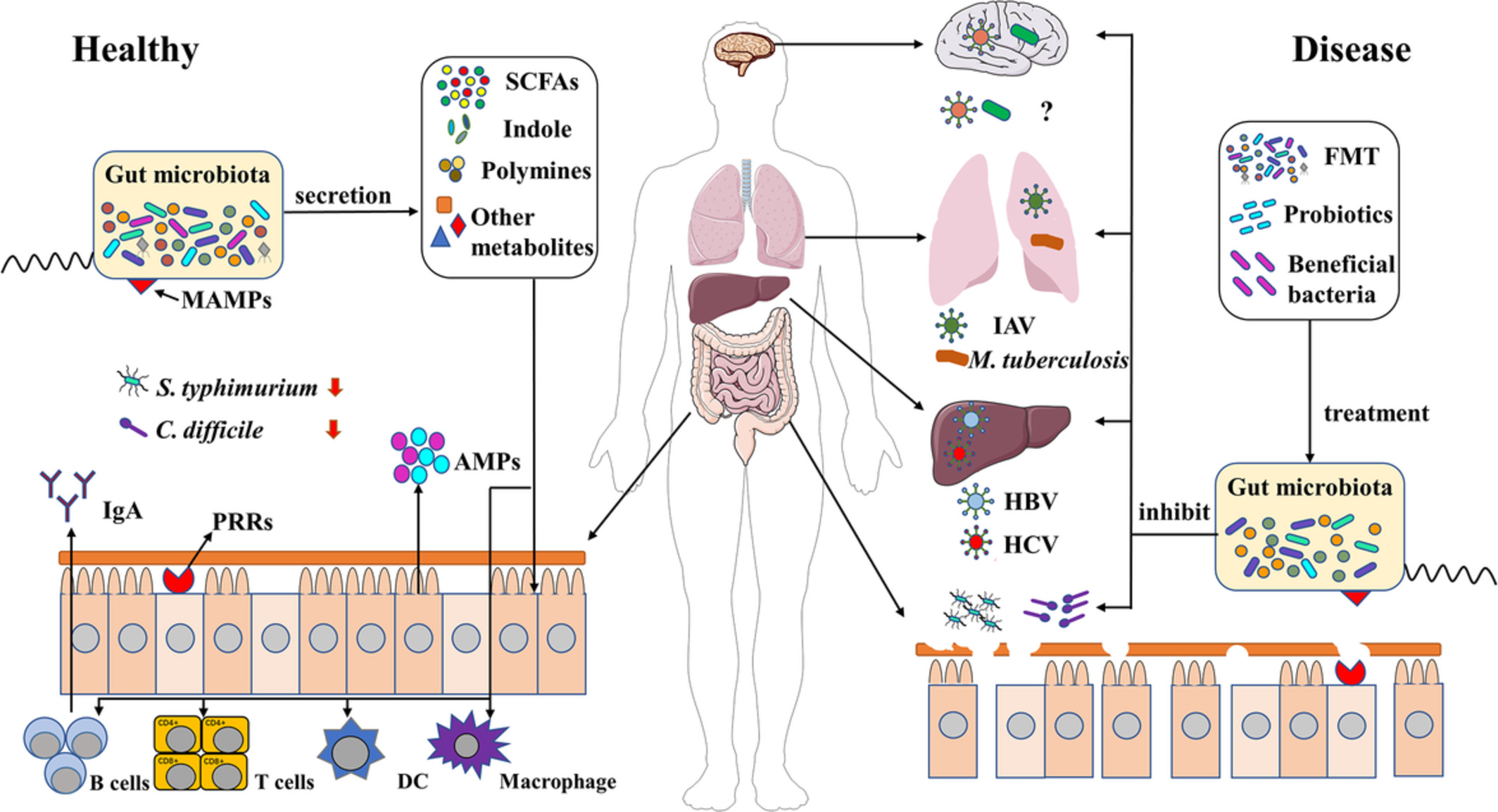 The role of gut microbiota in infectious diseases