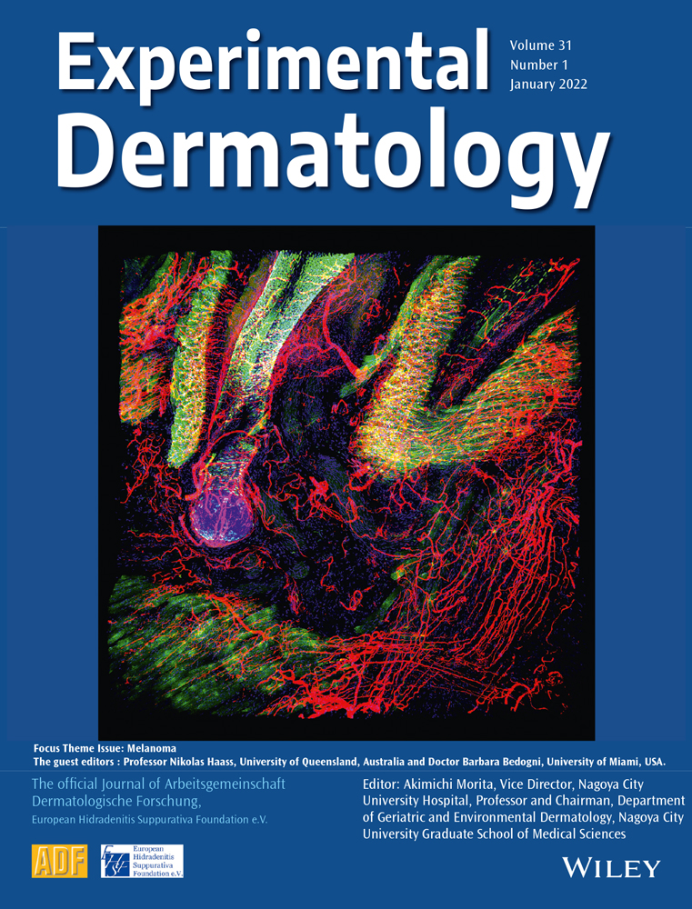 Ultra‐high‐frequency ultrasound and machine learning approaches for the differential diagnosis of melanocytic lesions