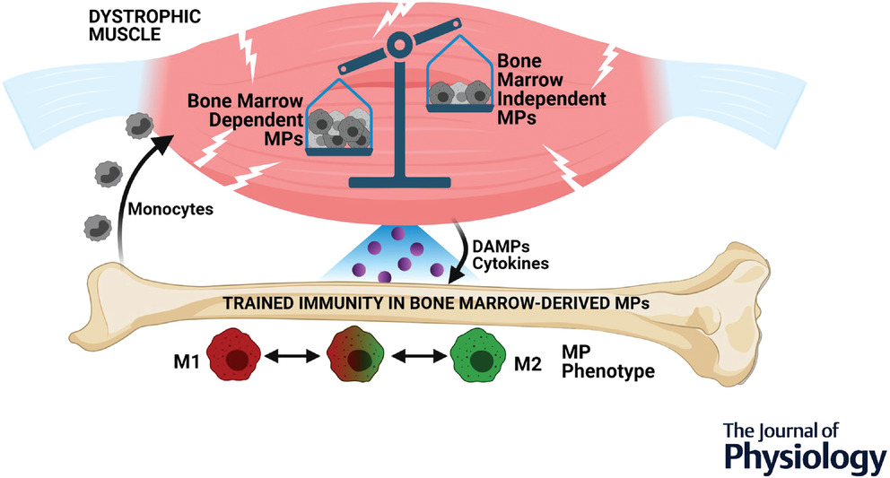 Macrophage plasticity in Duchenne muscular dystrophy: a nexus of pathological remodelling with therapeutic implications