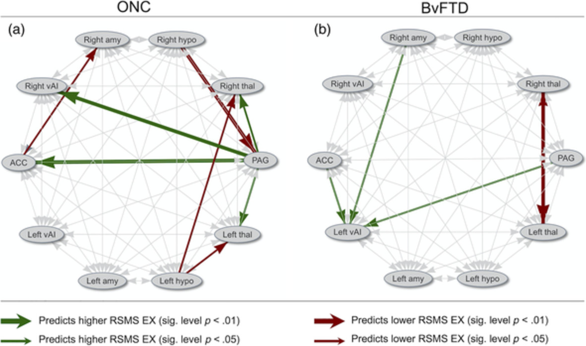 Influence of periaqueductal gray on other salience network nodes predicts social sensitivity