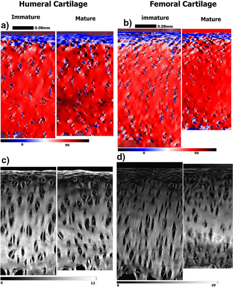 Structural differences between immature and mature articular cartilage of rabbits by microscopic MRI and polarized light microscopy