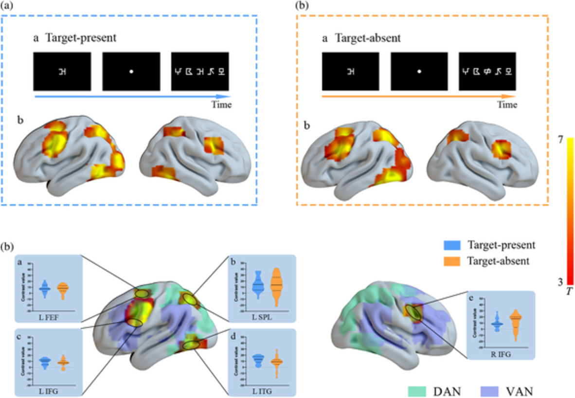 Involvement of the dorsal and ventral attention networks in visual attention span