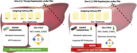 Aging reduces liver resiliency by dysregulating Hedgehog signaling