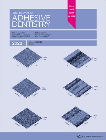 OCT Evaluation of Marginal and Internal Interface Integrity of Class V Composite Restorations after 36 to 48 Months