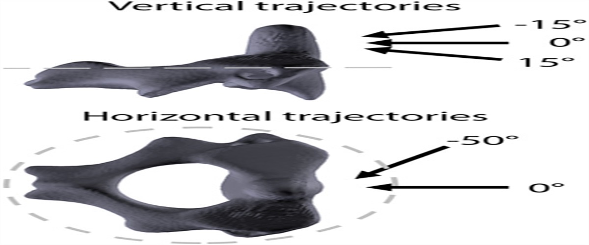 Biomechanical Assessment of Fracture Loads and Patterns of the Odontoid Process