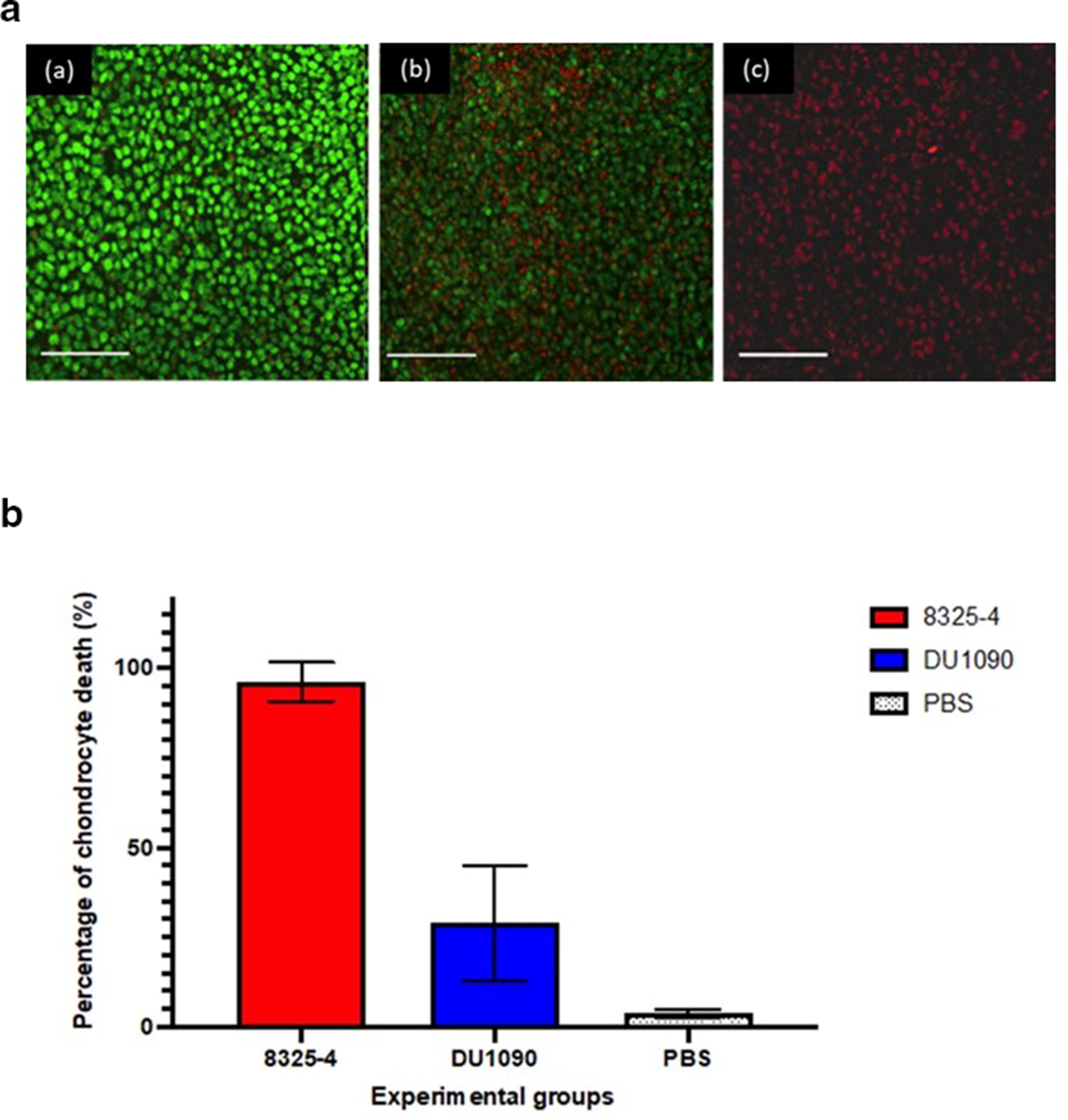 Septic arthritis in an in vivo murine model induced by Staphylococcus aureus