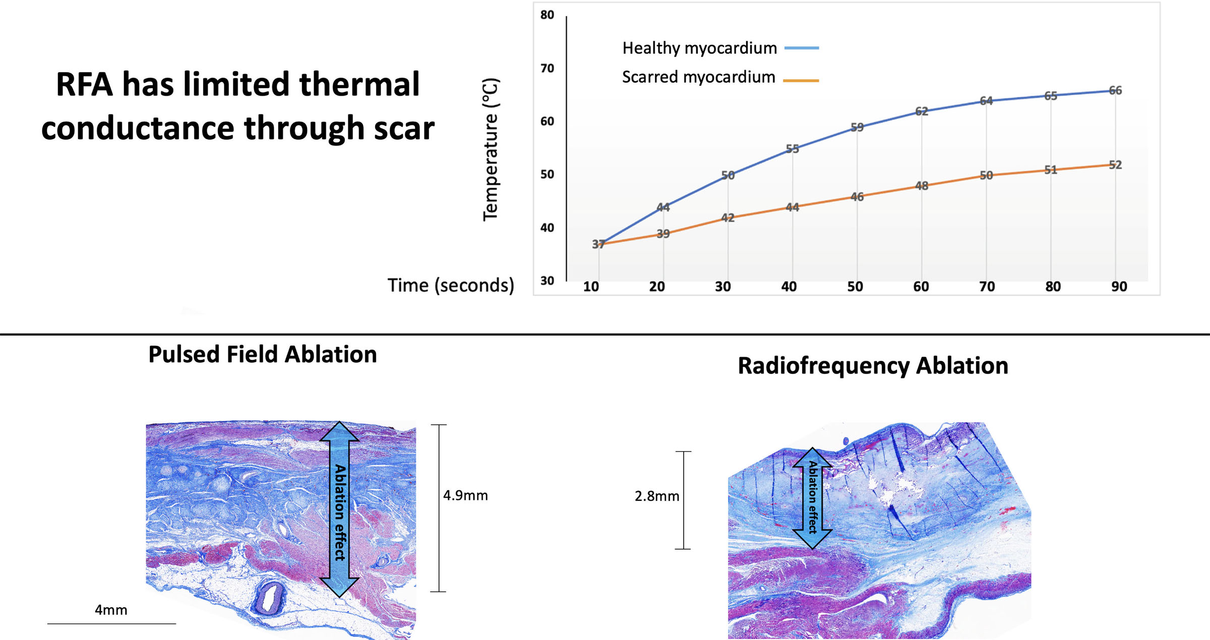 Effect of Pulsed-Field and Radiofrequency Ablation on Heterogeneous Ventricular Scar in a Swine Model of Healed Myocardial Infarction