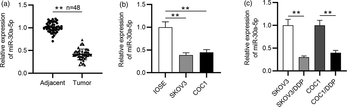MiR-30a-5p/CHD1 axis enhances cisplatin sensitivity of ovarian cancer cells via inactivating the Wnt/β-catenin pathway