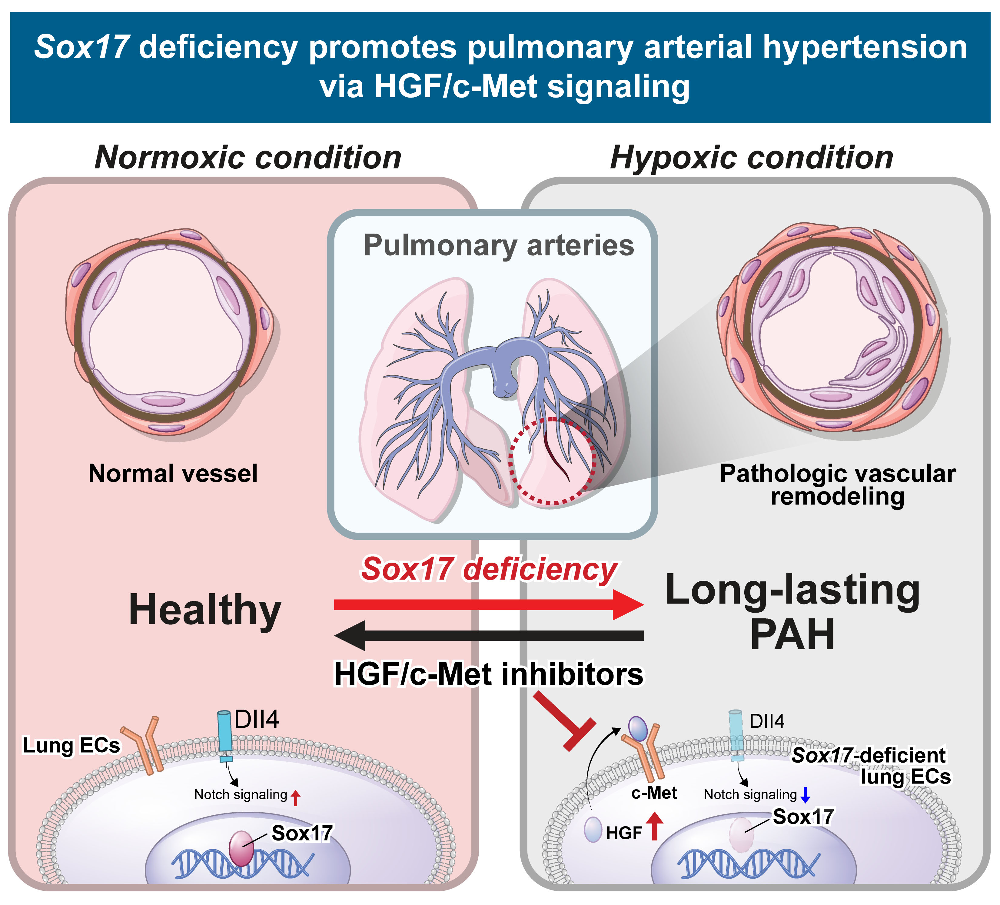 Sox17 Deficiency Promotes Pulmonary Arterial Hypertension via HGF/c-Met Signaling