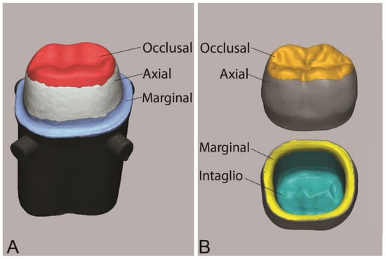 Dentistry Journal, Vol. 10, Pages 215: Fit, Precision, and Trueness of 3D-Printed Zirconia Crowns Compared to Milled Counterparts