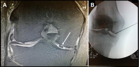 Protocols and Techniques for Orthobiologic Procedures