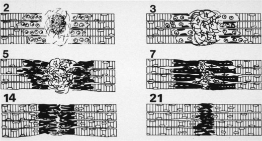 Orthobiologic Interventions for Muscle Injuries