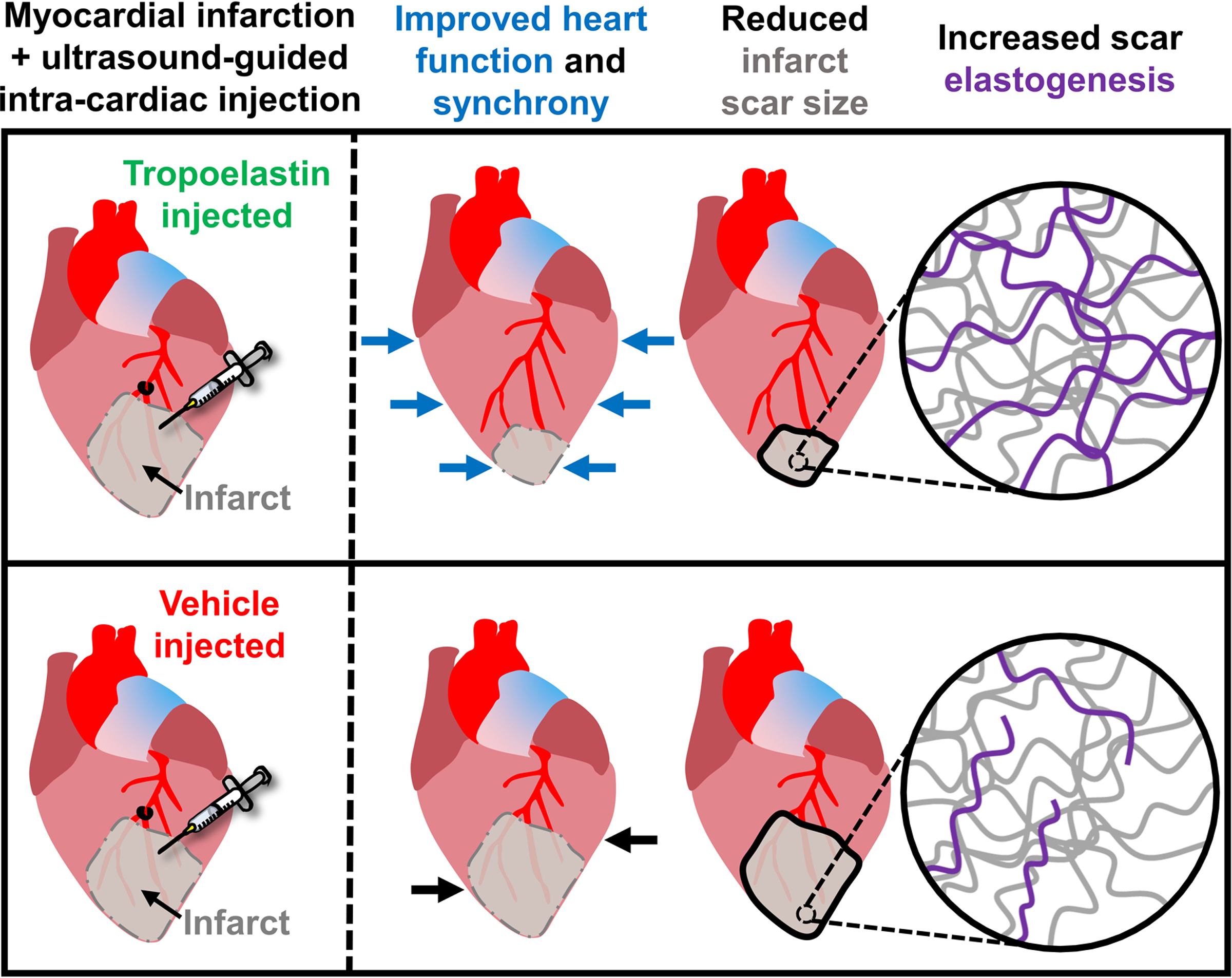Tropoelastin Improves Post-Infarct Cardiac Function by Increasing Scar Elastin
