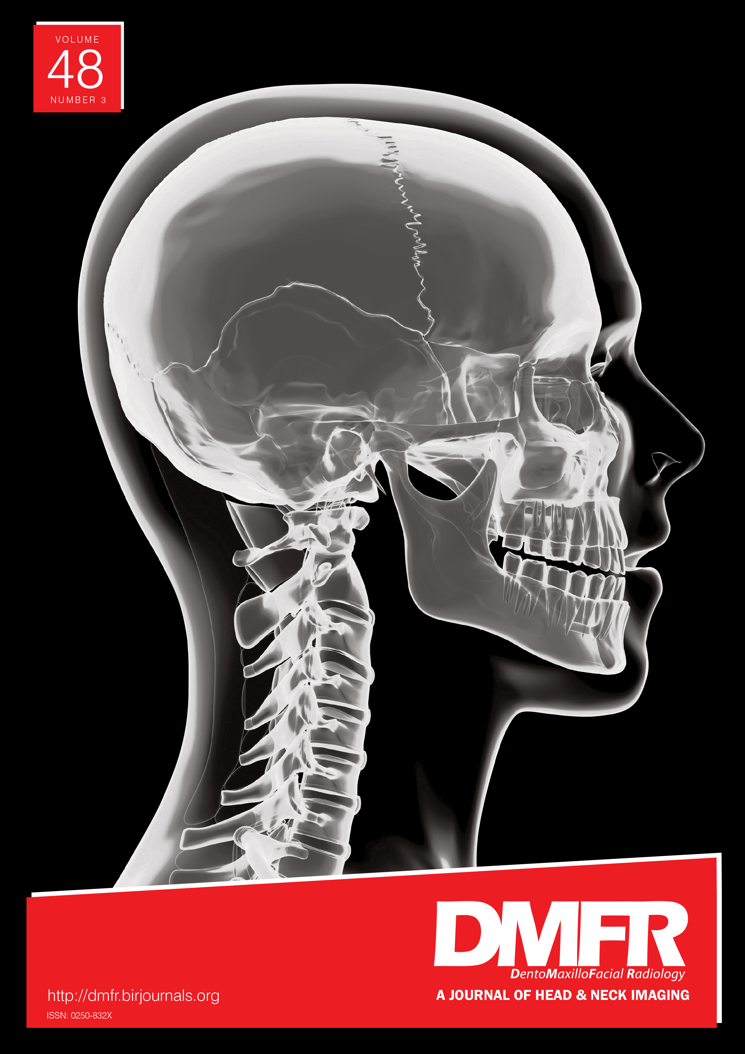 Factors affecting interpretation of dental radiographs