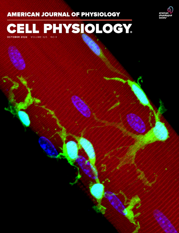 The impact of high fat feeding and Parkin overexpression on skeletal muscle mass, mitochondrial respiration and H2O2 emission