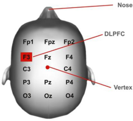 Healthcare, Vol. 11, Pages 84: Influence of Transcranial Direct Current Stimulation and Exercise on Fatigue and Quality of Life in Multiple Sclerosis