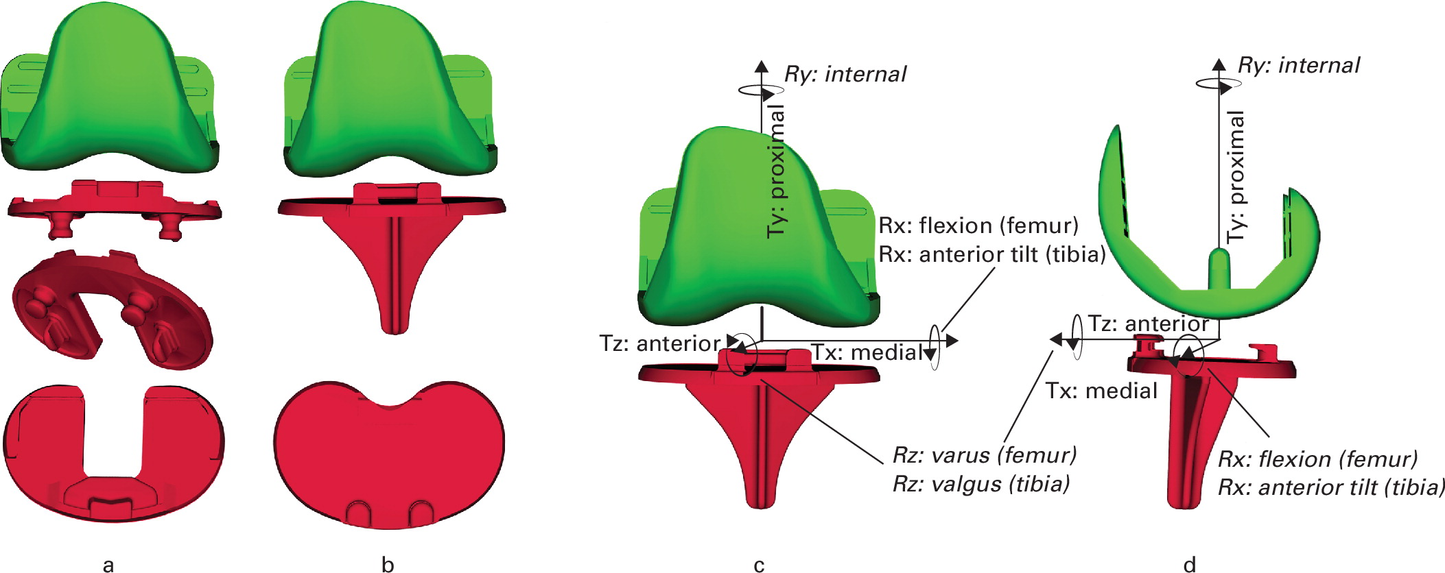 Fluoroscopic and radiostereometric analysis of a bicruciate-retaining versus a posterior cruciate-retaining total knee arthroplasty: a randomized controlled trial