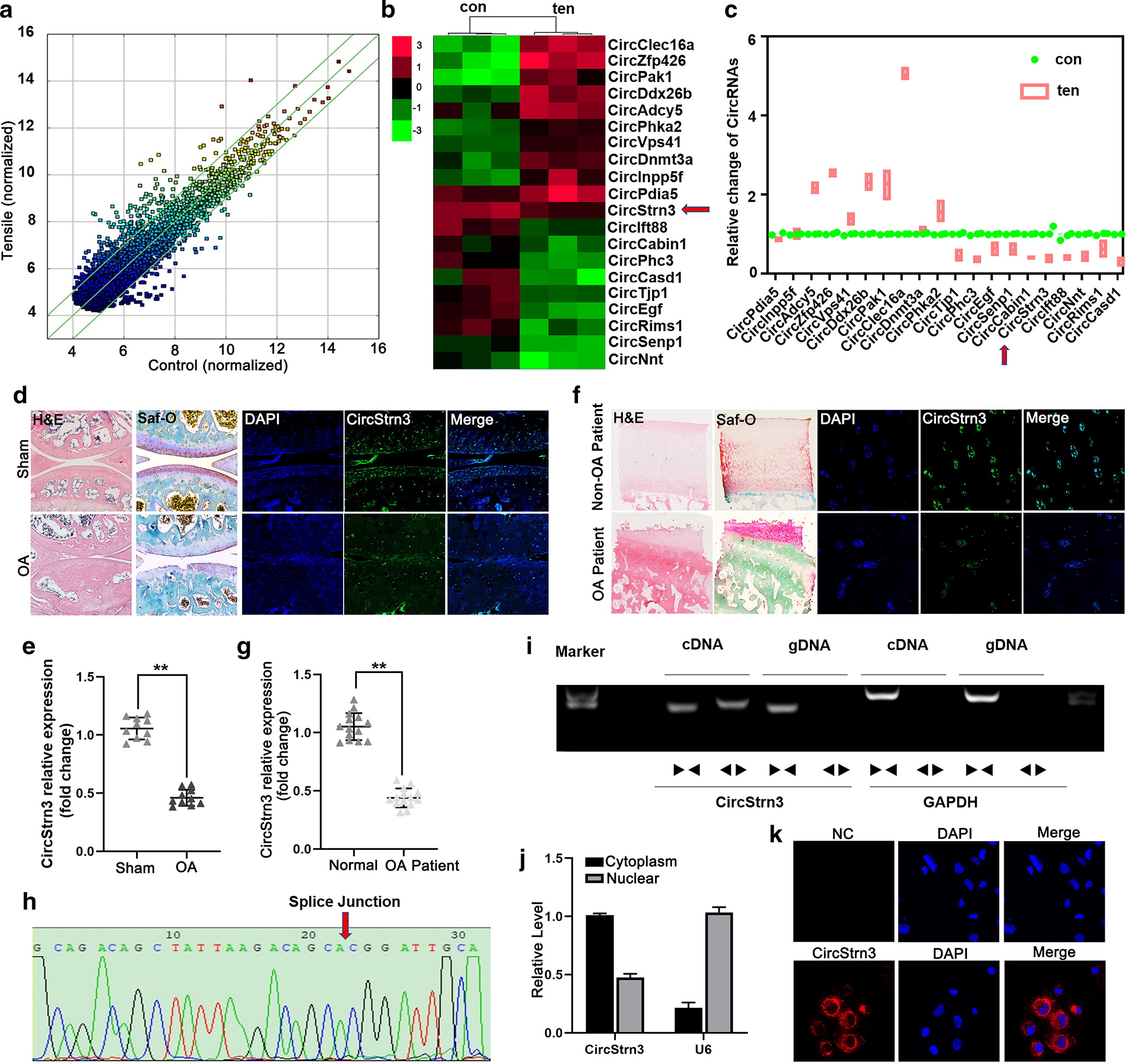 CircStrn3 targeting microRNA-9-5p is involved in the regulation of cartilage degeneration and subchondral bone remodelling in osteoarthritis