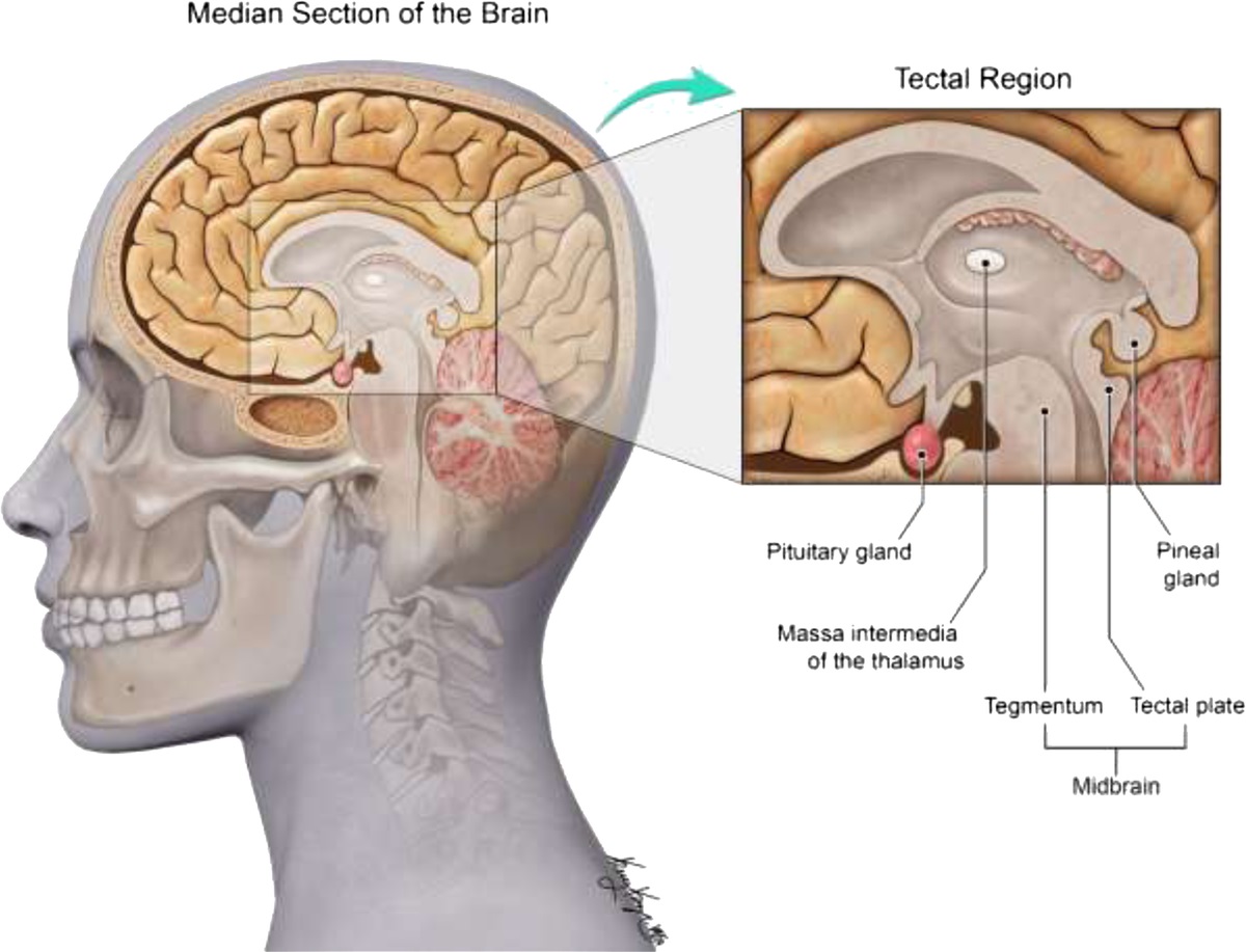 Retrospective Analysis of Imaging Characteristics of Tectal Gliomas