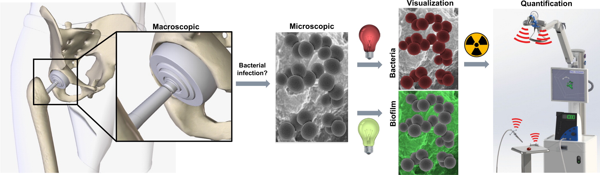 A radio- and fluorescently labelled tracer for imaging and quantification of bacterial infection on orthopaedic prostheses