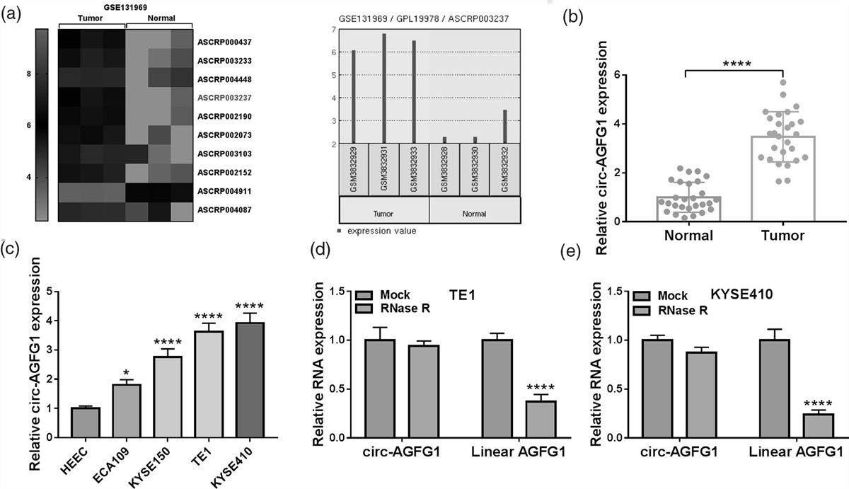 Circular RNA circ-AGFG1 contributes to esophageal squamous cell carcinoma progression and glutamine catabolism by targeting microRNA-497-5p/solute carrier family 1 member 5 axis