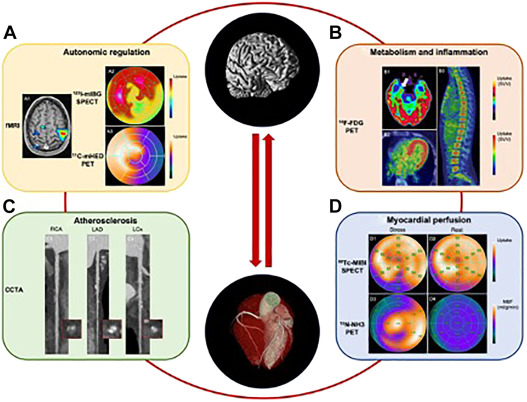 Radionuclide Imaging of Heart-Brain Connections