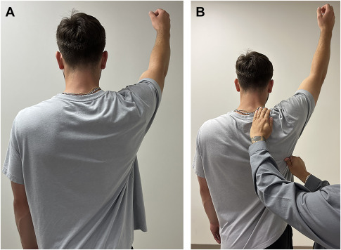 Managing Scapular Dyskinesis