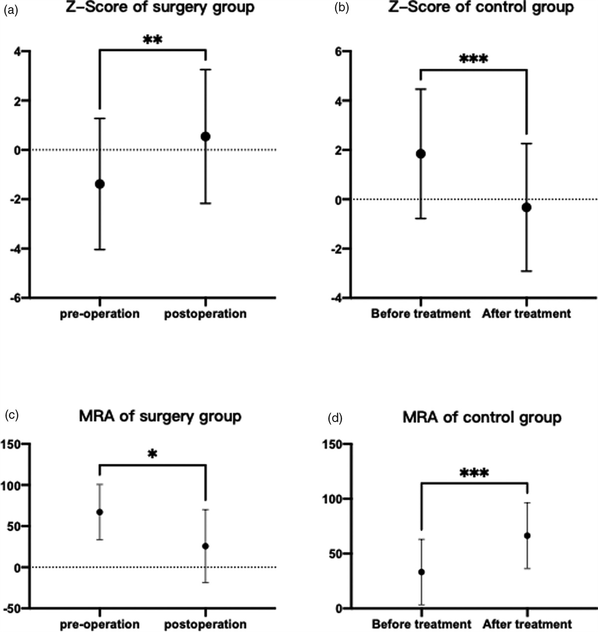 Using eZIS of SPECT to evaluate the therapeutic effect of carotid endarterectomy