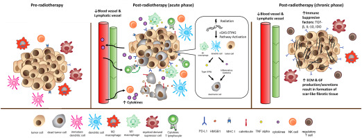 Advances in Radiotherapy Immune Modulation