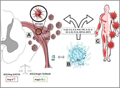 Post-Acute Sequelae of SARS-CoV-2 (PASC): Musculoskeletal Conditions and Pain